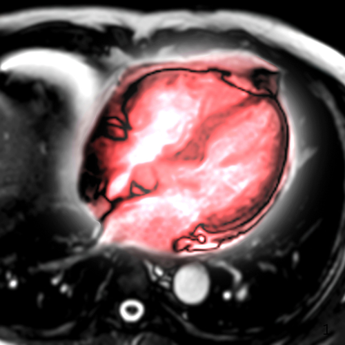 View of Why Cardiac Imaging is Booming: A Guide for Diagnostic Imaging Centers ...