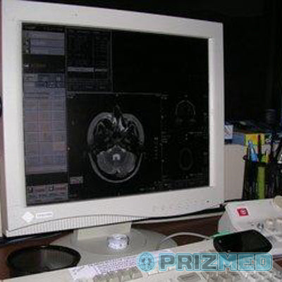 Refurbished Toshiba Excelart 1.5T MRI Equipment For Sale - PrizMED