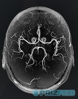 Refurbished 32-Channel Head Coil — 3 Tesla For Sale - PrizMED Imaging