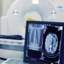 Refurbished GE Signa Hero 3.0T MRI Equipment For Sale - PrizMED Imaging